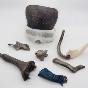 3D implant (đang cập nhật)